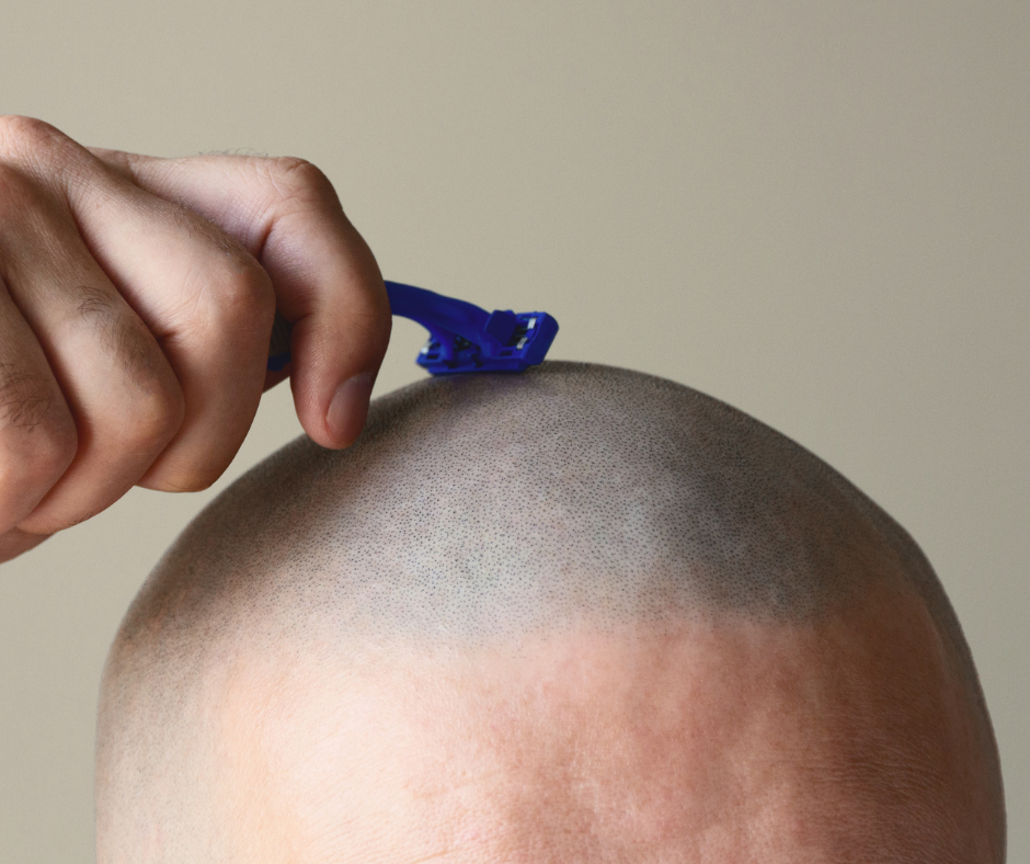 How to Shave Your Head