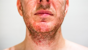 The Connection Between Stress and Beard Health