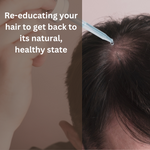 Load image into Gallery viewer, Men&#39;s Hair Growth Serum - Australian Made Hair Loss Treatment
