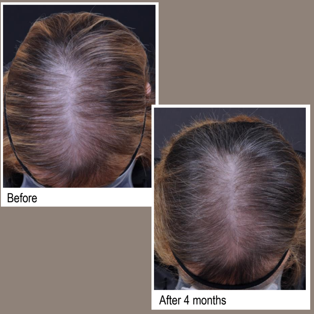 Hair Growth Serum - Australian Made Hair Loss Treatment
